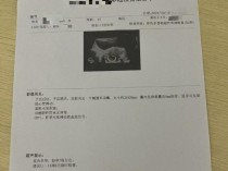 女子代孕后被怀疑非客户胎儿遭拉黑 求助无门陷困境