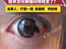 女生火车上戴美瞳睡觉忘记摘直接碎眼里