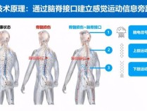 复旦团队脑脊接口研究获突破 脊髓损伤患者行走希望重启