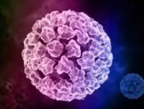 男子被误诊感染HPV：10天花光积蓄 工作也辞了